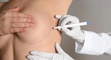 İşte meme estetiği ameliyatı hakkında en çok merak edilen 7 soru!