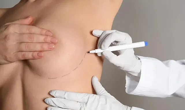 İşte meme estetiği ameliyatı hakkında en çok merak edilen 7 soru!